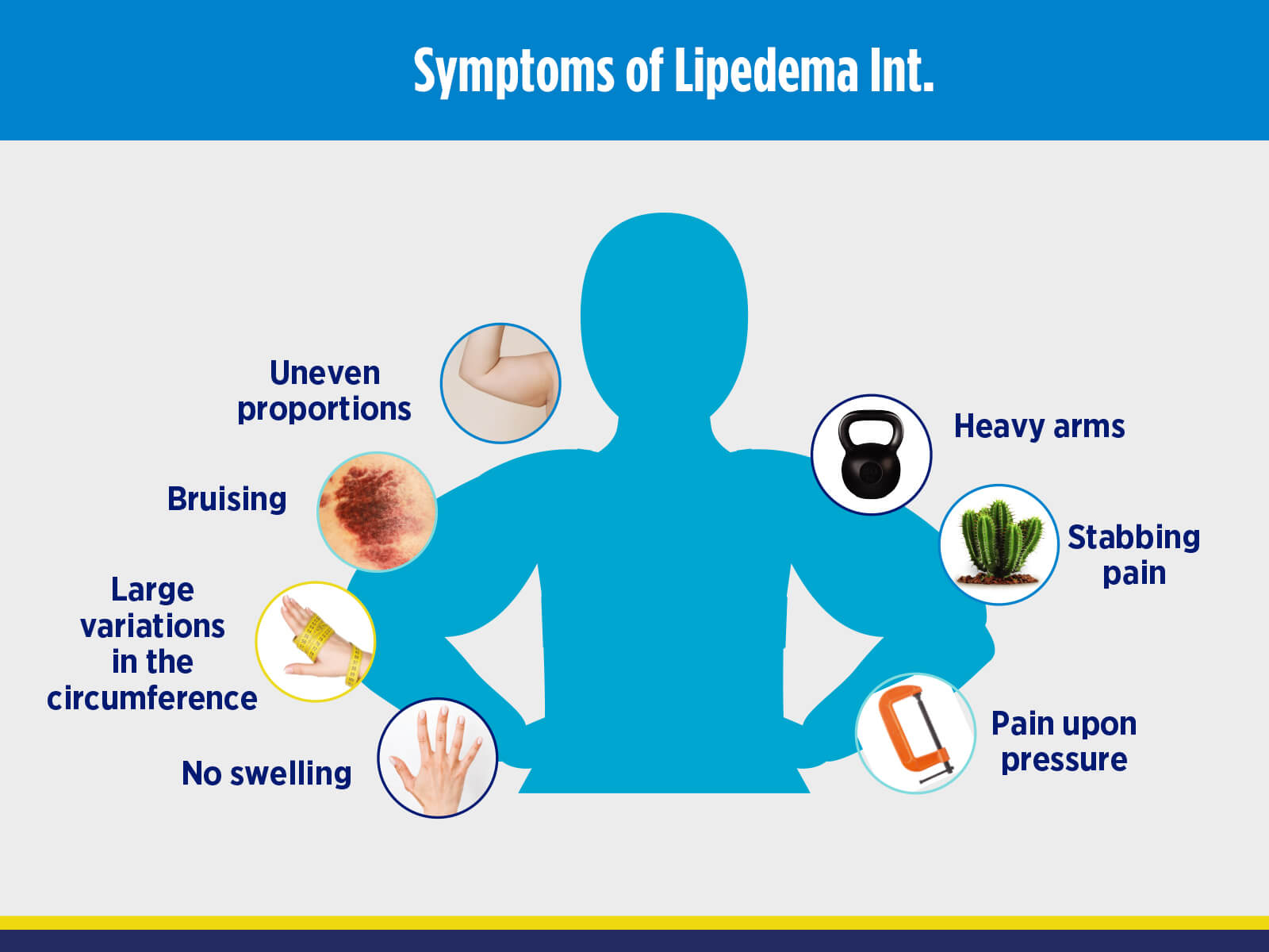 Symptoms Lipedema Int.