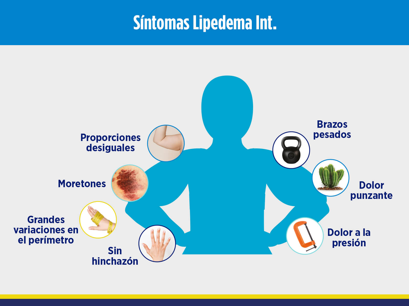 Sintomas Lipedema Int.