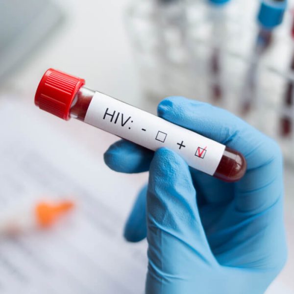 The Power of Prevention: New Ways to Tackle HIV in Puerto Rico